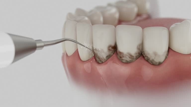 Trusted Dental Implants service in Cedar Heights, MD - Dentist Open Now